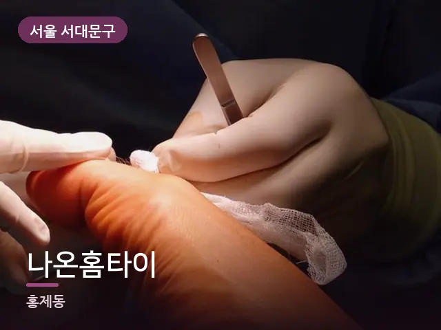 서울 서대문구 나온홈타이 — 발 관리 장면